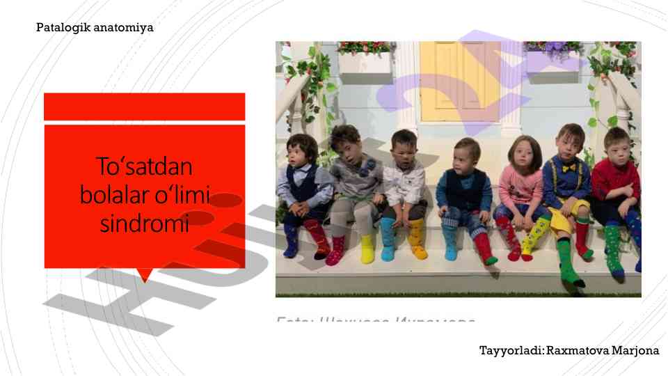 To'satdan chaqaloq o'limi sindromi tahlili