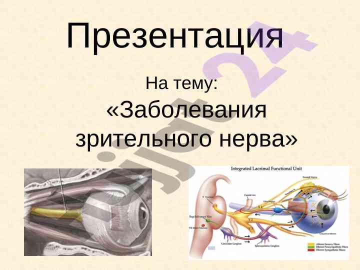 Заболевания зрительного нерва и их классификация