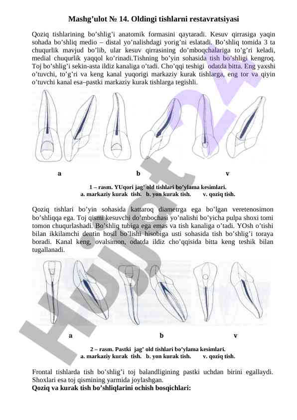 Tishlarning restavratsiyasi va anatomik formen