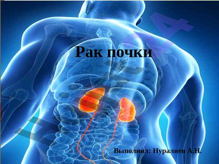 Рак почки: этиология, диагностика и классификация