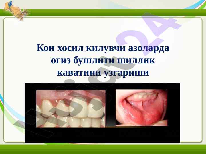 Кон хосил килувчи азоларда лейкоз бемаоралари
