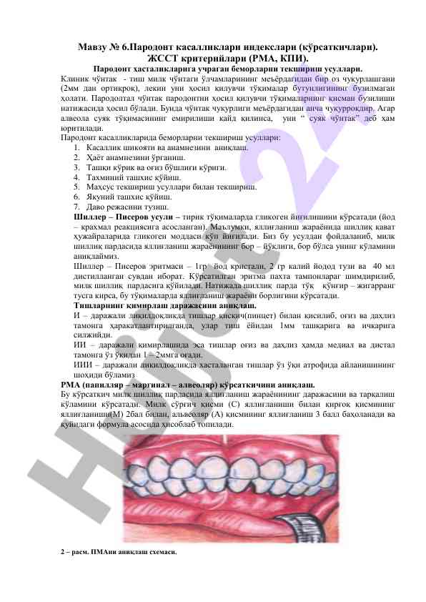 Пародонт касалликлари индекслари ва текшириш усуллари