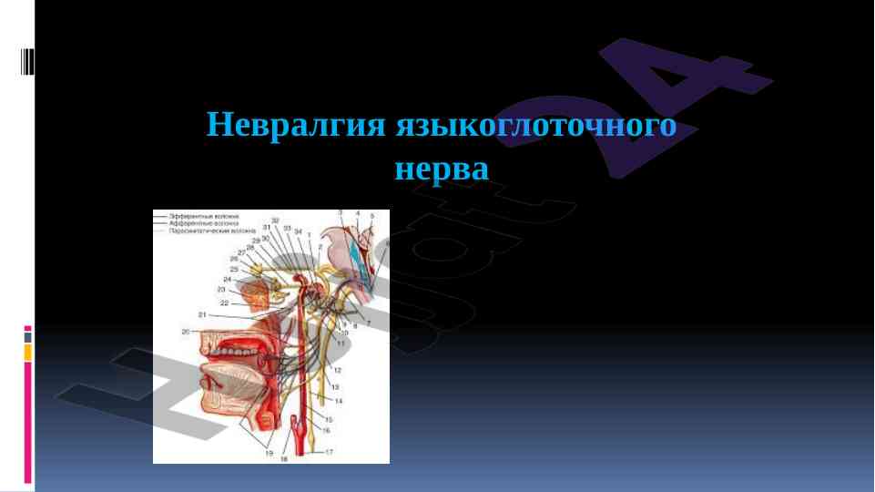 Nevralgiya yazykgilotchnogo nerva