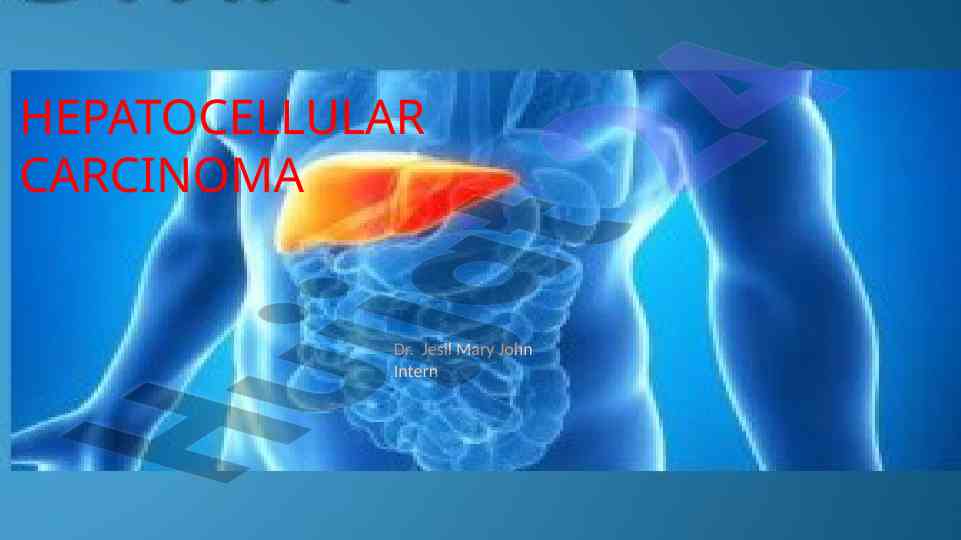 Hepatocellular carcinoma overview and recent advances