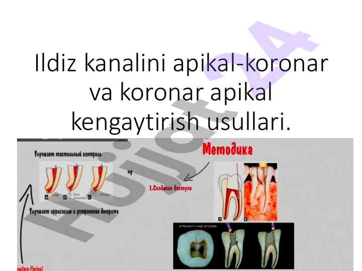 Ildiz kanalini kengaytirish usullari tahlili