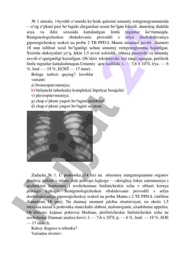 14 yoshli o'smirda ko'krak qafasi rentgenogrammasi
