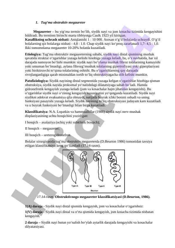 Tug‘ma obstruktiv megaureter patologiyasi haqida