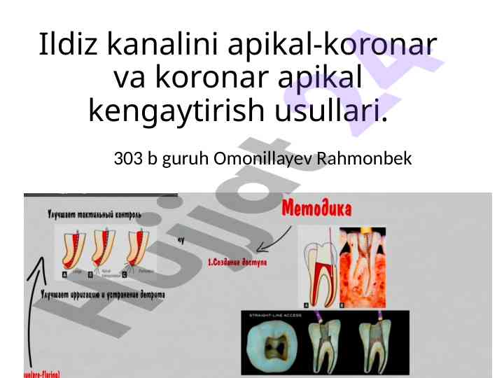 Ildiz kanalini apikal-koronar usullari