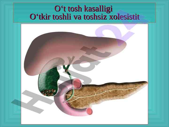 O‘t tosh kasalligi va o‘t pufagi fiziologiyasi