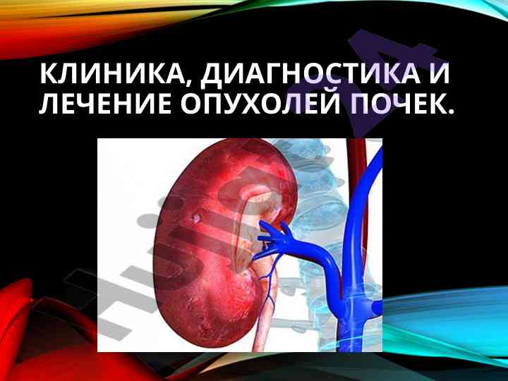 Диагностика и лечение опухолей почек