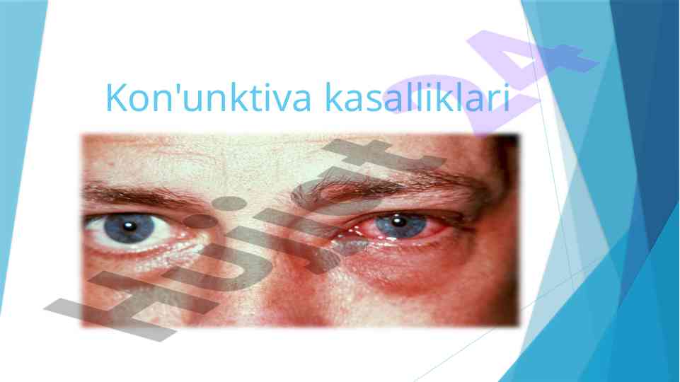 Konyunktiva kasalliklari va tajribalari tahlili
