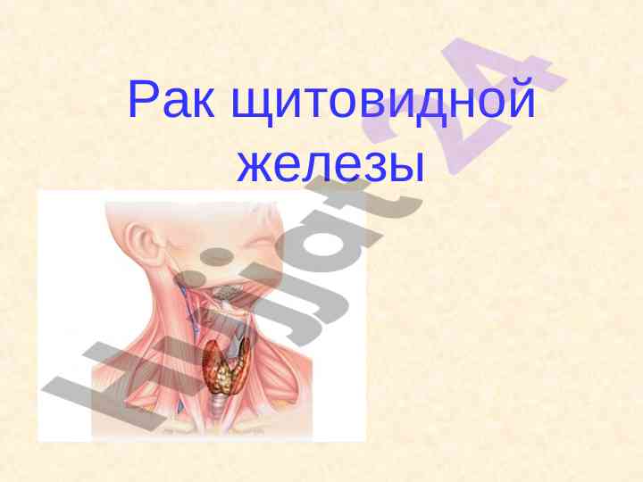 Рак щитовидной железы: онкологические процессы