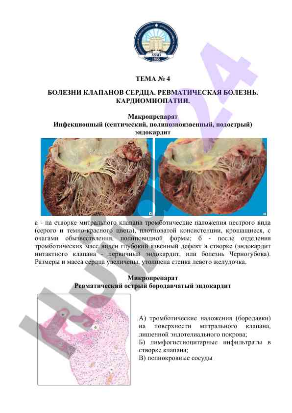 Bolzni klapanov serdtsa rеvmaticheskaya bоlеzn