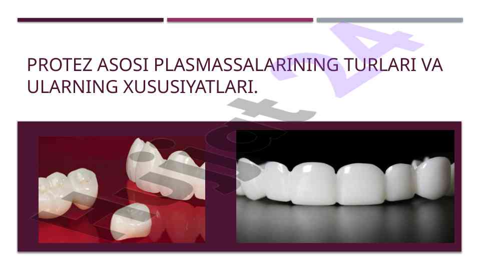 Protez asosi plasmassalarining turlari va xususiyatlari