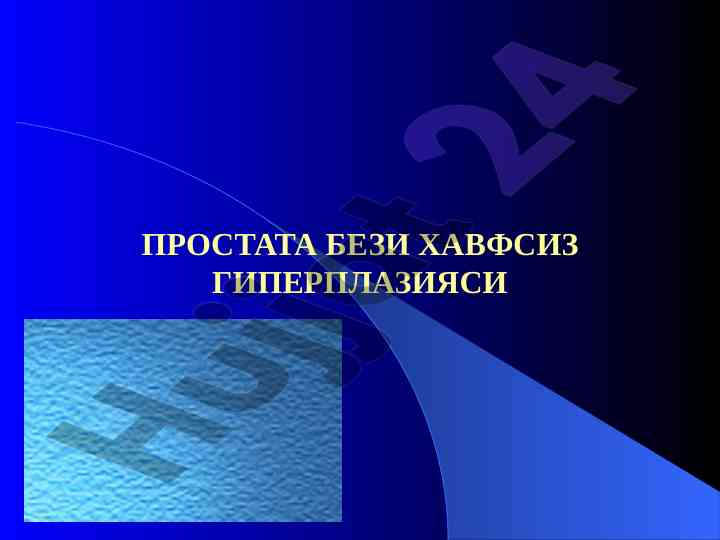 Простата бези ҳавфсиз гиперплазияси тўғрисида тадқиқот