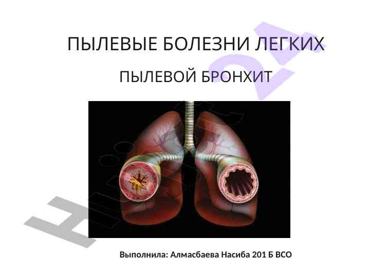 Пылевые болезни легких и пылевой бронхит