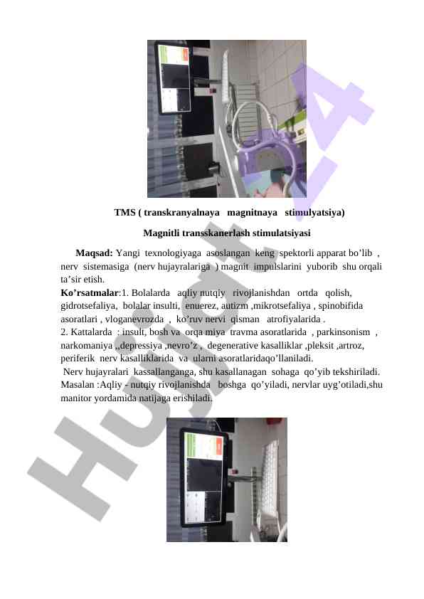 Magnitli stimulatsiya va nerv tizimiga ta'siri