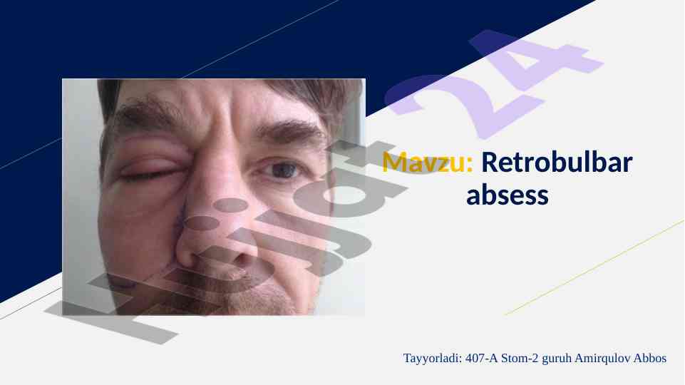 Retrobulbar absess tushunchasi va lor bilan bog‘liqligi