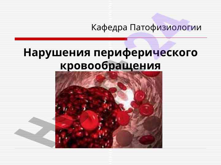 Narusheniya perifericheskogo krovobrasheniya