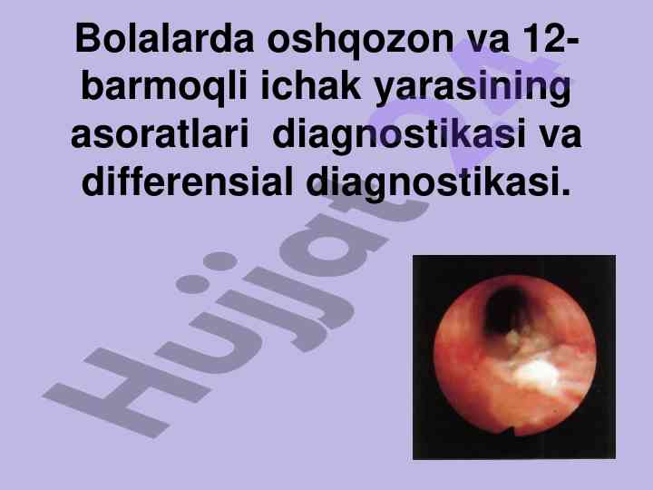 Bolalarda oshqozon va 12 barmoqli ichak yarasi diagnostikasi