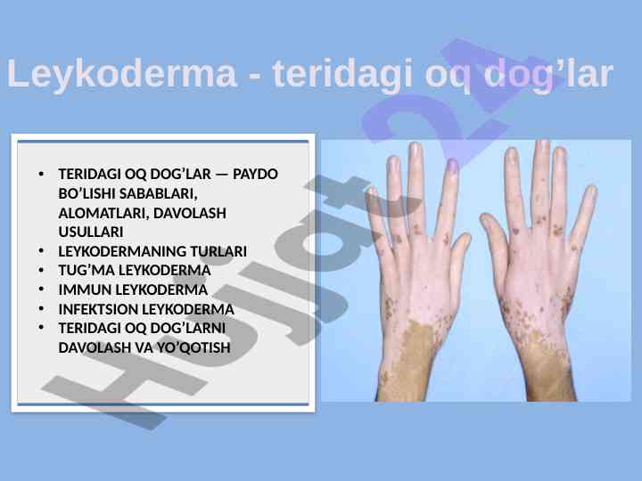 Leykoderma: teridagi oq dog'lar sabablari va davolash