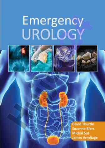 Emergency urology clinical insights and research