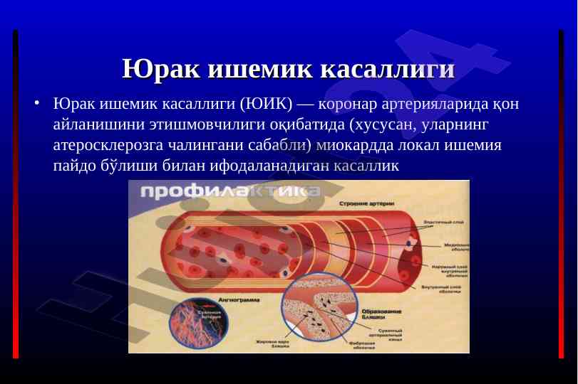 Юрак ишемик касаллигини даволаш тaktikalari