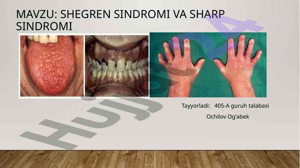 Shegren sindromi va sharp sindromi tahlili