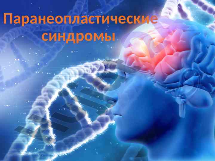 Паранеопластические синдромы и их классификация
