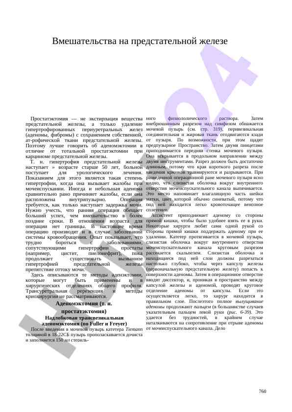 Vmeshatel'stva na prestdatel'noy zheleze