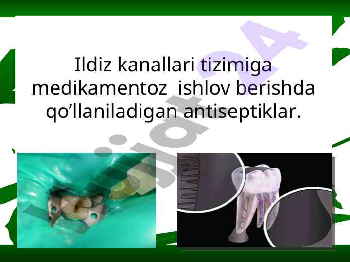 Ildiz kanallarida antiseptiklarni qo'llash asoslari