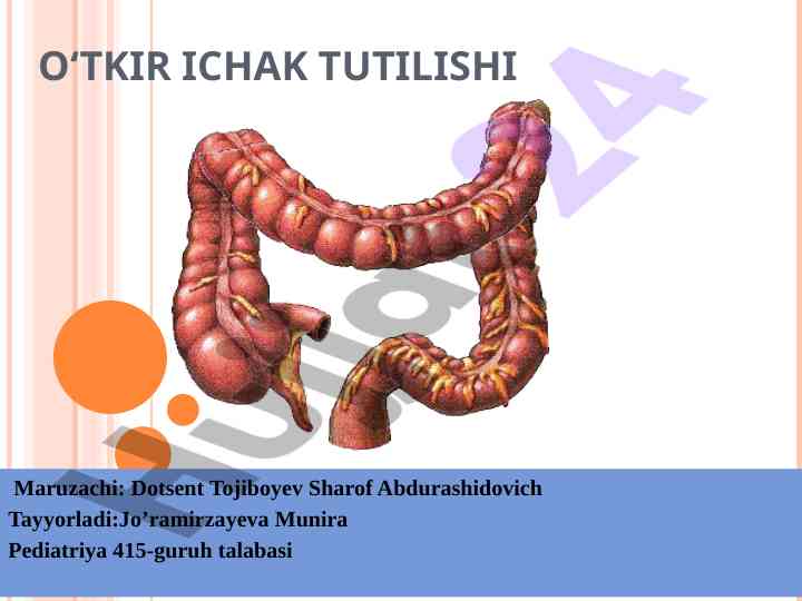 Ichak tutilishi kasalliklari va ularning tahlili