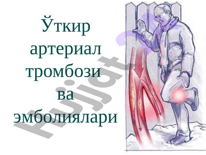 Уткир артериал тромбози ва эмболиялари таркалганлиги