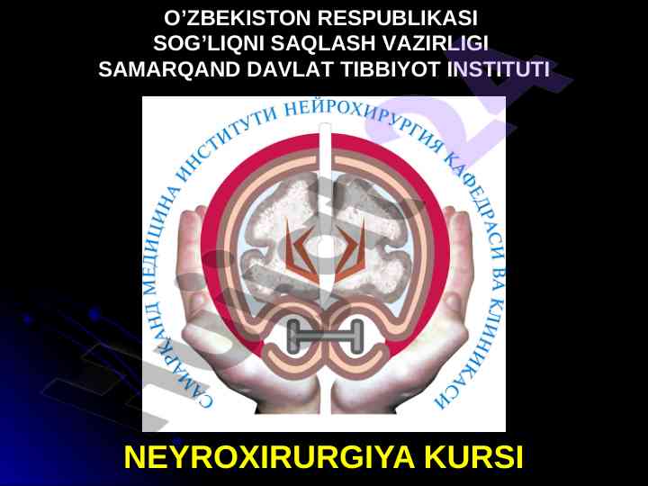 Umurtqa pog‘onasi va orqa miya travmalari tahlili
