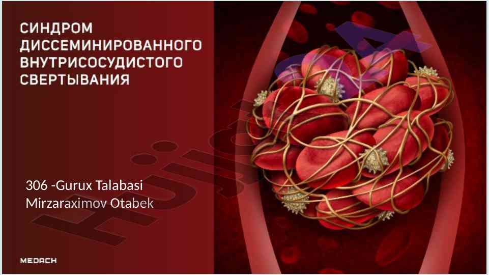Dvs sindromi patogenezi va klassifikatsiyasi
