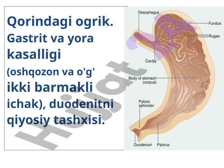 Surunkali gastrit va yara kasalligi tahlili