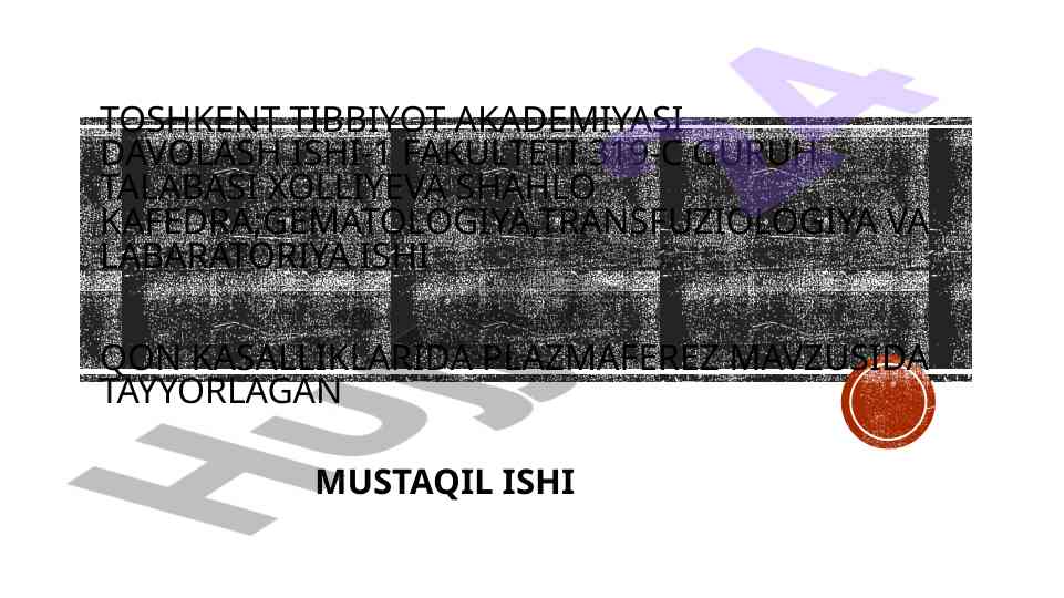 Plazmaferez - Qonni Tozalashning Zamonaviy Usuli