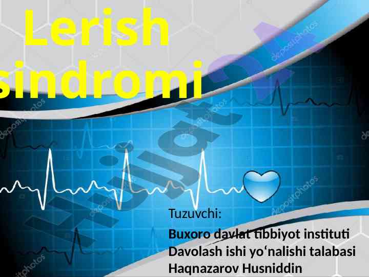 Lerish sindromi va uning tasnifi